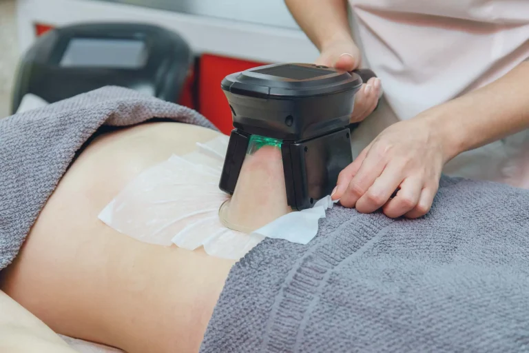 Legacy e Coolsculpting: Por que fazer esses procedimentos estéticos?