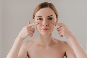 Descubra o laser PADRÃO OURO para o tratamento do melasma STARWALKER