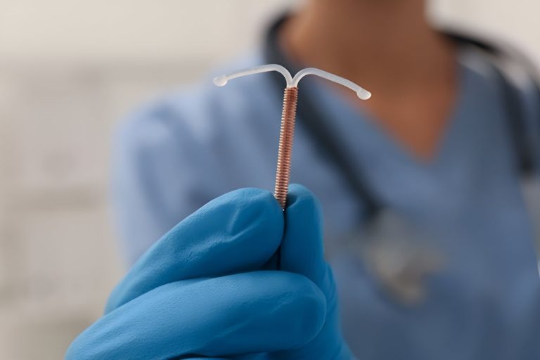 DIU o que é? Descubra Tudo Sobre Este Método Contraceptivo Eficaz
