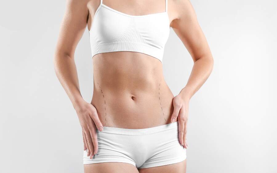 Qual o Procedimento para Abdominoplastia? Descubra Todos os Detalhes