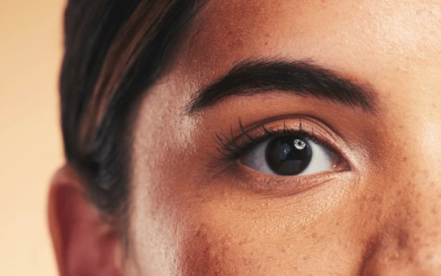 Como Tratar Melasma na Pele