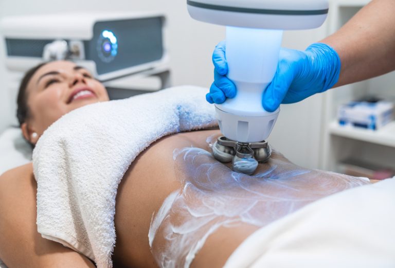 CoolSculpting
