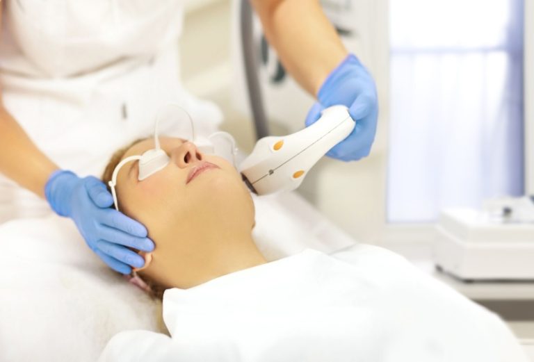 Opções de tratamento para melasma