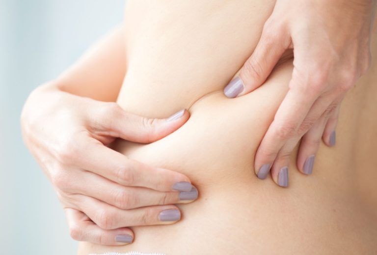 Gordura localizada: o que é, causas e o que fazer para tratar