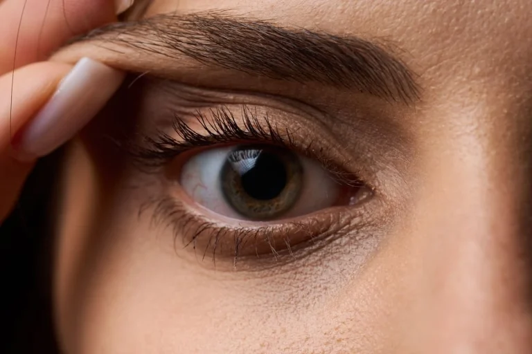 Blefaroplastia