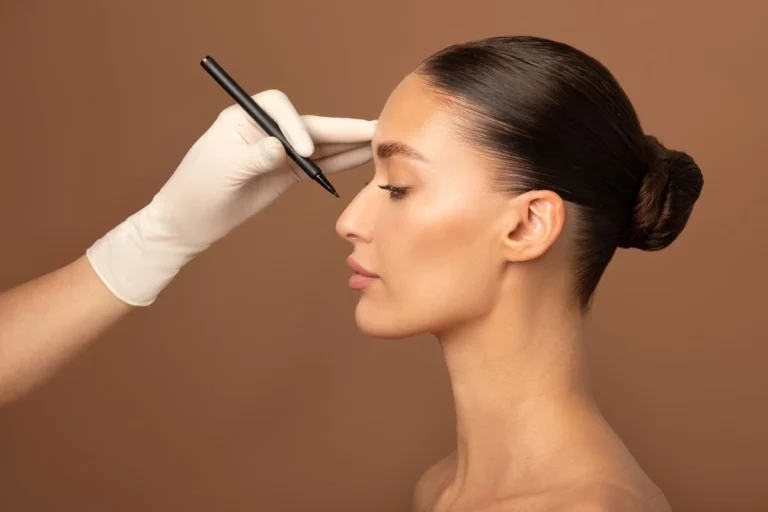 Rinoplastia